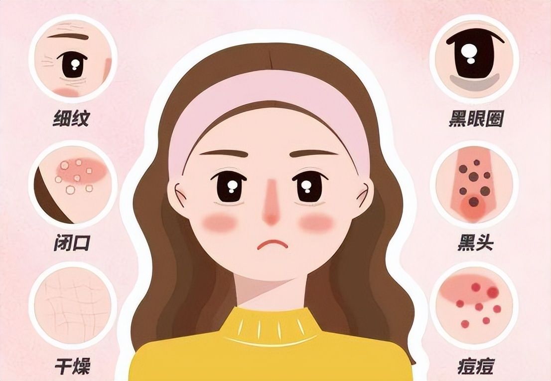 黑頭毛孔粗大油皮怎么辦_毛孔粗大黑頭多皮膚油應(yīng)該怎么辦_黑頭毛孔粗大油膩用什么產(chǎn)品好